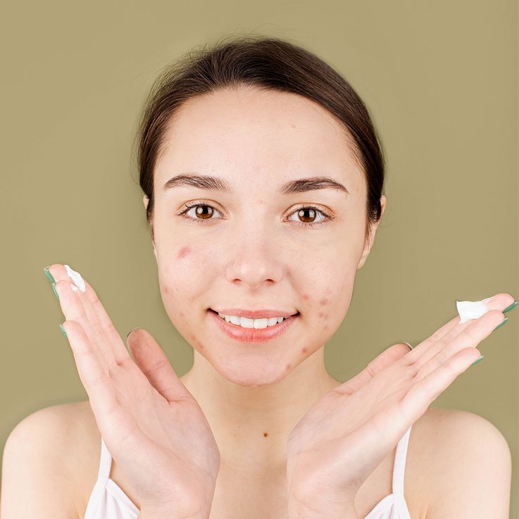 Piel Grasa: todo lo que tienes que saber