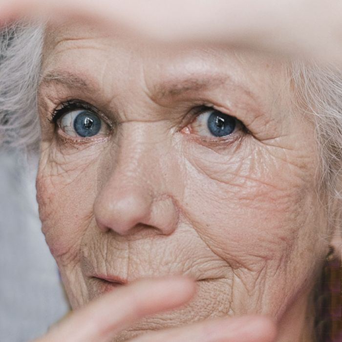 Arrugas verticales: ¿cómo se originan y cómo tratarlas?