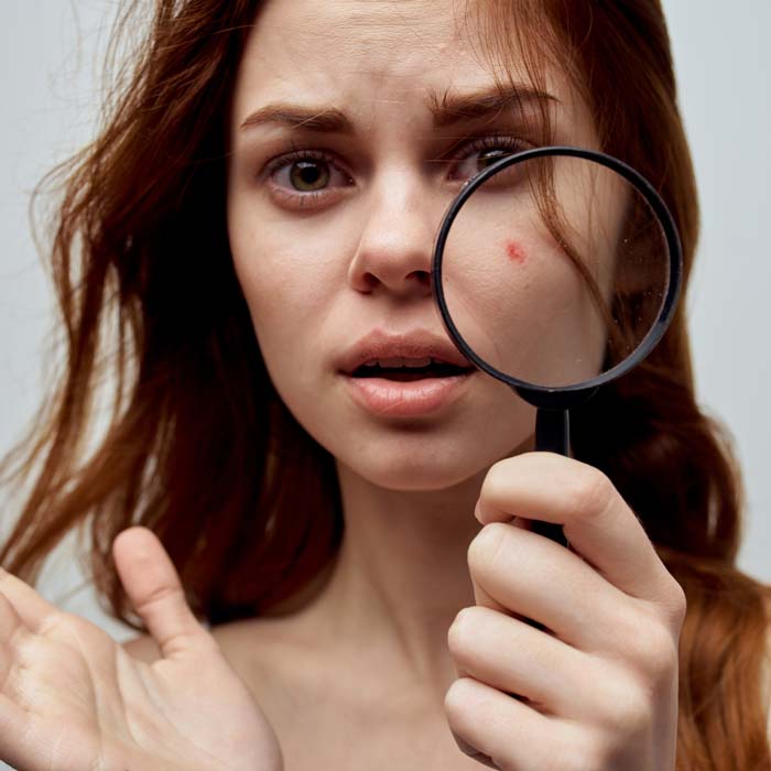 ¿Cómo quitar las manchas de la cara?