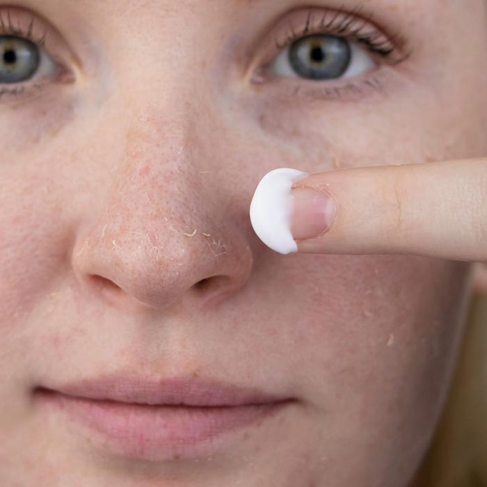 ¿Qué es la Piel Alípica y cómo se diferencia de la Piel Seca?